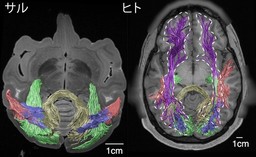 サルとヒトの視覚情報を伝える線維束の類似性を発見 ～最新MRIで136年前の古典的研究成果を再発見～