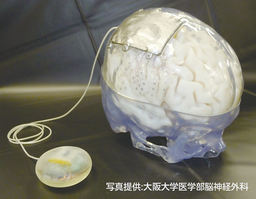 世界初の埋込型皮質脳波ブレイン・マシン・インターフェースシステムを展示